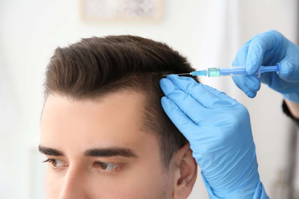 Hair Transplant UK – Premium Treatments, Affordable Prices
