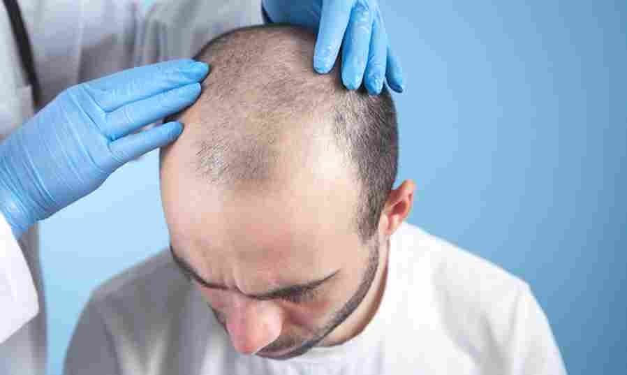Hair Transplant Istanbul – Personalized Hair Restoration Solutions