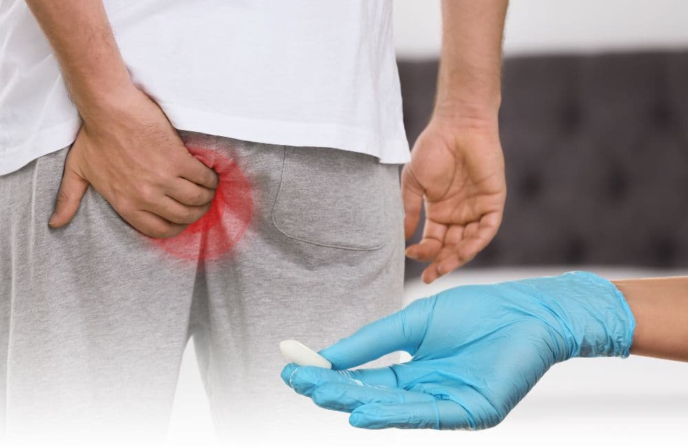 Effective External Hemorrhoid Treatment That Works